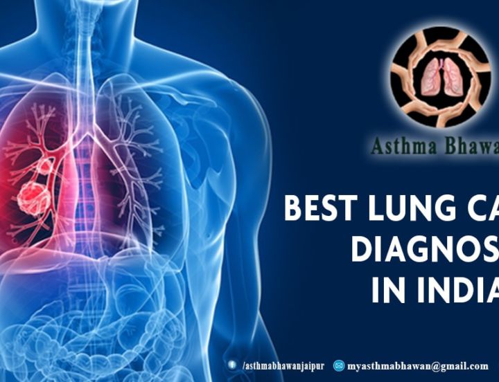 Best Lung Cancer Diagnosis in Jaipur Archives Asthma Bhawan