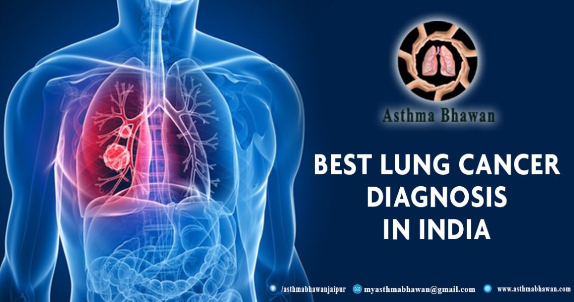 best Lung Cancer Diagnosis in india