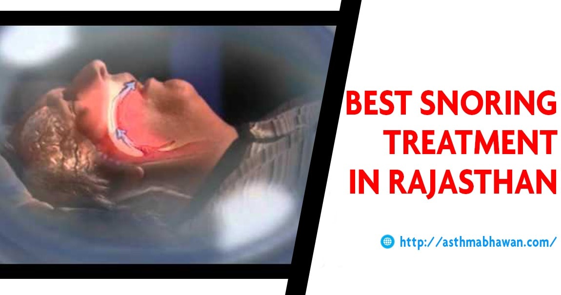 Best Snoring Treatment in Rajasthan, Snoring Treatment Hospital In India