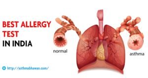 Best Allergy Test In India - Asthma Bhawan