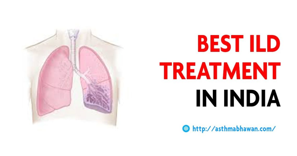 Best ILD treatment In Rajasthan | Interstitial Lung Disease Treatment