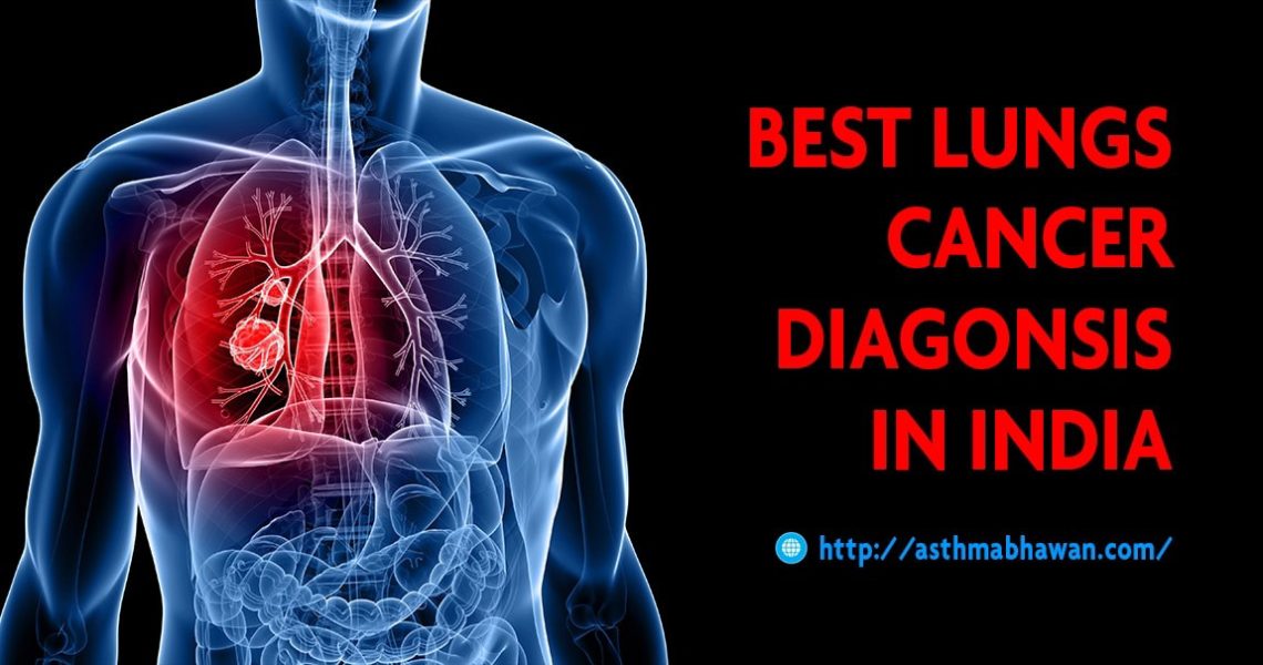 Best Lungs Cancer Diagnosis in Rajasthan