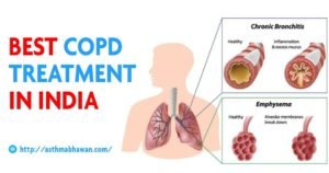 Best COPD Treatment in Jaipur