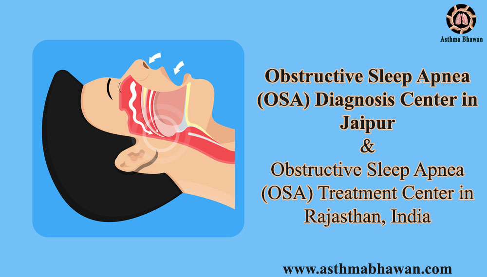 Obstructive sleep apnea OSA Diagnosis Center in Jaipur