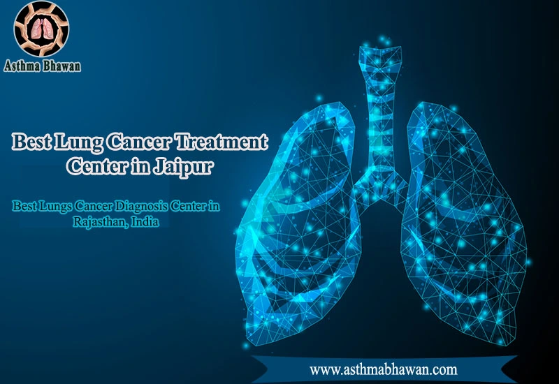 Best Lung Cancer Treatment Center in Jaipur - Asthma Bhawan