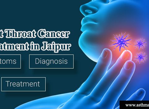 Best Throat Cancer Treatment in Jaipur