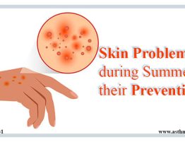 Skin Problems during Summer and their Prevention