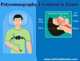 Polysomnography Treatment in Jaipur