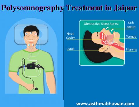 Polysomnography Treatment in Jaipur