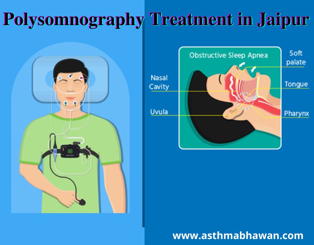 Polysomnography Treatment in Jaipur- Procedure | Importance | Risk - Asthma Bhawan
