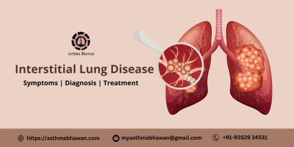 Interstitial Lung Diseaseild Symptoms Diagnosis And Treatment