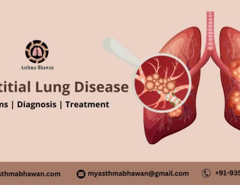 Interstitial Lung Disease(ILD) | Symptoms, Diagnosis and Treatment