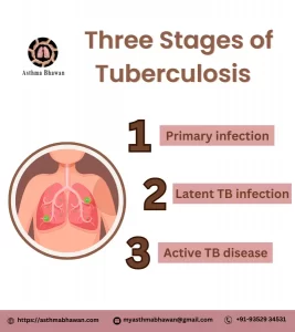 Three Stages of Tuberculosis - Asthma Bhawan