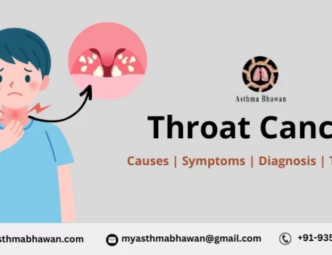 Throat Cancer - Causes, Symptoms, Diagnosis, and Treatment