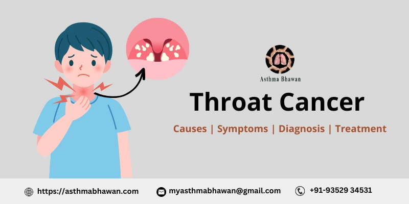 Throat Cancer - Causes, Symptoms, Diagnosis, and Treatment